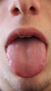 舌位置が正常化する