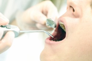 レジンはアクセサリーだけでなく、歯の治療にも使われることがあります。