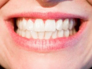 teeth-1652976_640　口元　歯　顔